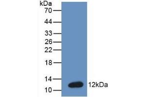 Detection of Recombinant BNP, Mouse using Monoclonal Antibody to Brain Natriuretic Peptide (BNP) (BNP 抗体  (AA 77-121))