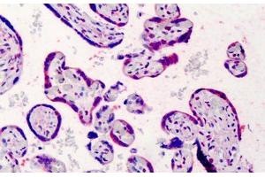 Human Placenta: Formalin-Fixed, Paraffin-Embedded (FFPE) (Bcl-2 抗体  (FITC))