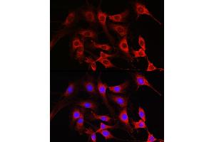 Immunofluorescence (IF) image for anti-RAC1 (AA 1-192) antibody (ABIN6146616)