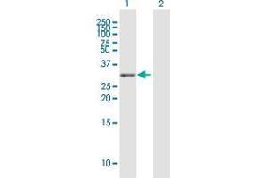 Western Blot analysis of TNFRSF13C expression in transfected 293T cell line by TNFRSF13C MaxPab polyclonal antibody. (TNFRSF13C 抗体  (AA 1-184))