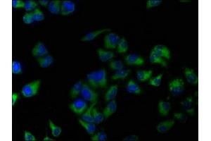 Immunofluorescence staining of Hela cells with ABIN7144538 at 1:133, counter-stained with DAPI. (ALOX15 抗体  (AA 1-225))