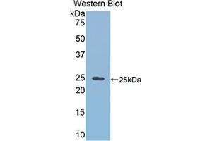 Detection of Recombinant RALBP1, Mouse using Polyclonal Antibody to RalA Binding Protein 1 (RALBP1) (RALBP1 抗体  (AA 192-380))