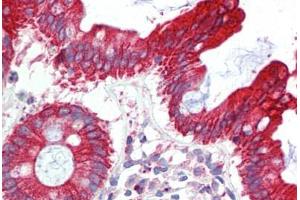 Human Colon (formalin-fixed, paraffin-embedded) stained with UBE2L3 antibody ABIN462238 followed by biotinylated goat anti-rabbit IgG secondary antibody ABIN481713, alkaline phosphatase-streptavidin and chromogen. (UBE2L3 抗体  (C-Term))