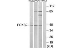 Western blot analysis of extracts from HeLa/LOVO/A549 cells, using FOXB2 Antibody. (FOXB2 抗体  (AA 251-300))