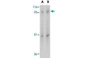 Western blot analysis of SLC39A10 in human spleen tissue lysate with SLC39A10 polyclonal antibody  at (A) 1 and (B) 2 ug/mL . (SLC39A10 抗体  (Internal Region))