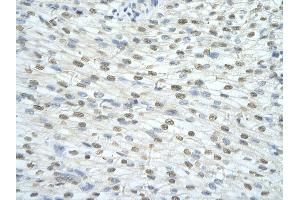 Rabbit Anti-SF3A1 antibody         Paraffin Embedded Tissue:  Human Heart    cell Cellular Data:  cardiac cell    Antibody Concentration:  4. (SF3A1 抗体  (N-Term))