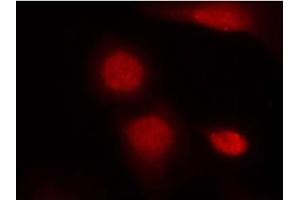 Image no. 1 for anti-Androgen Receptor (AR) (pSer213) antibody (ABIN319225) (Androgen Receptor 抗体  (pSer213))