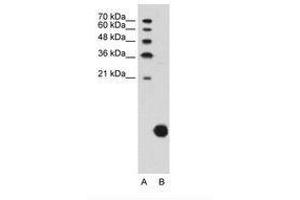 Image no. 1 for anti-Ribosomal Protein S29 (RPS29) (C-Term) antibody (ABIN203394) (RPS29 抗体  (C-Term))
