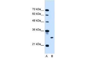 RNF39 antibody used at 2. (RNF39 抗体  (C-Term))