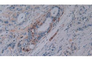 Immunohistochemistry (IHC) image for anti-Secreted phosphoprotein 1 (SPP1) (AA 18-314) antibody (ABIN7442486)