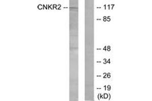 Western blot analysis of extracts from Jurkat cells, using CNKR2 Antibody. (CNKSR2 抗体  (AA 641-690))