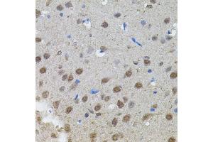 Immunohistochemistry of paraffin-embedded rat brain using MYCN antibody. (MYCN 抗体)