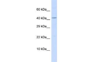 Host:  Rabbit  Target Name:  BM Sample Type:  MCF7 Whole Cell lysates  Antibody Dilution:  1. (BMP10 抗体  (C-Term))