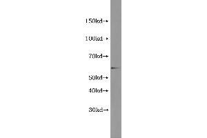 Western Blotting (WB) image for Terminal Complement Complex C5b-9 (C5b-9) ELISA Kit (ABIN1117376) (C5b-9 ELISA 试剂盒)