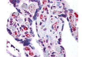 Immunohistochemistry (IHC) image for anti-Apoptosis-Inducing Factor, Mitochondrion-Associated, 2 (AIFM2) (Middle Region) antibody (ABIN2792236) (AIFM2 抗体  (Middle Region))