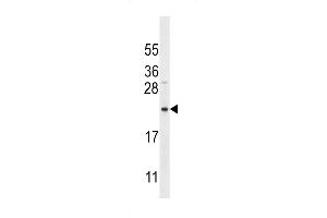 Bit1 Antibody (K95) (ABIN650622 and ABIN2846297) western blot analysis in MDA-M cell line lysates (35 μg/lane). (PTRH2 抗体  (AA 80-110))