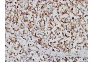 Immunoperoxidase of monoclonal antibody to FH on formalin-fixed paraffin-embedded human seminoma. (FH 抗体  (AA 33-510))