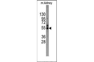 Image no. 1 for anti-Matrix Metallopeptidase 12 (Macrophage Elastase) (MMP12) (C-Term) antibody (ABIN358685) (MMP12 抗体  (C-Term))