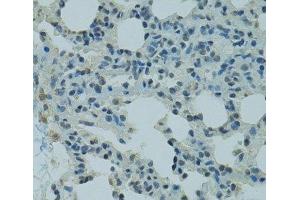 Immunohistochemistry of paraffin-embedded Rat lung using PRDM2 Polyclonal Antibody at dilution of 1:100 (40x lens). (PRDM2 抗体)