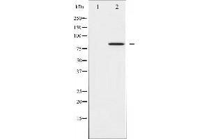 Western Blotting (WB) image for anti-Signal Transducer and Activator of Transcription 4 (STAT4) (pTyr693) antibody (ABIN6256790)