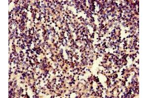 Immunohistochemistry of paraffin-embedded human spleen tissue using ABIN7157042 at dilution of 1:100 (IRF3 抗体  (AA 1-452))