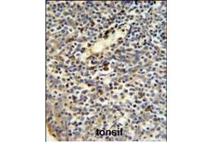 Immunohistochemistry (Paraffin-embedded Sections) (IHC (p)) image for anti-FK506 Binding Protein 11, 19 KDa (FKBP11) (AA 52-82), (N-Term) antibody (ABIN390761)