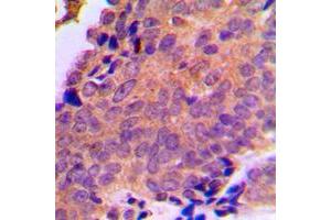 Immunohistochemistry (IHC) image for anti-Solute Carrier Family 25 (Mitochondrial Carrier, Adenine Nucleotide Translocator), Member 6 (SLC25A6) (Center) antibody (ABIN7299070)