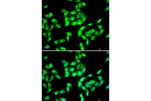 Immunofluorescence analysis of HeLa cells using ANTXR1 antibody (ABIN5973910). (ANTXR1 抗体)