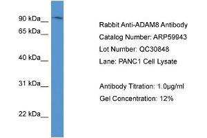 WB Suggested Anti-ADAM8  Antibody Titration: 0. (ADAM8 抗体  (N-Term))