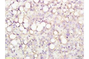 Formalin-fixed and human liver tissue labeled with Anti-USP-1 Polyclonal Antibody, Unconjugated  at 1:200 followed by conjugation to the secondary antibody and DAB staining