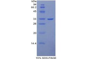 SDS-PAGE analysis of Mouse ITIH1 Protein. (ITIH1 蛋白)