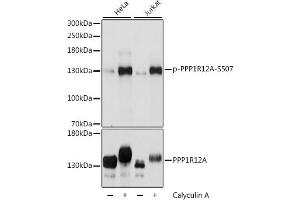 Western blot analysis of extracts of various cell lines, using Phospho-PPP1R12A-S507 antibody (ABIN6135287, ABIN6136196, ABIN6136197 and ABIN6225664) at 1:2000 dilution or PPP1R12A antibody (ABIN6128260, ABIN6146059, ABIN6146061 and ABIN6213896). (PPP1R12A 抗体  (pSer507))