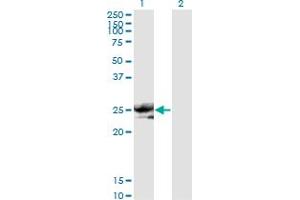 Western Blot analysis of NOG expression in transfected 293T cell line by NOG monoclonal antibody (M11), clone 2C10. (NOG 抗体  (AA 27-145))