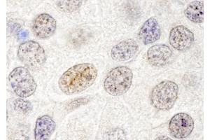 Immunohistochemistry (IHC) image for anti-GATA Zinc Finger Domain Containing 2B (GATAD2B) (AA 50-100) antibody (ABIN7448709)