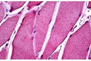 Immunohistochemistry (Formalin-fixed Paraffin-embedded Sections) (IHC (fp)) image for anti-ATPase, Class VI, Type 11B (ATP11B) (N-Term) antibody (ABIN626129)