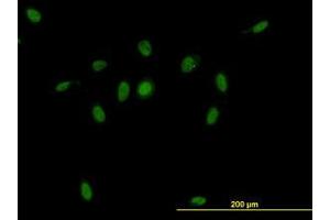 Image no. 1 for anti-CSE1 Chromosome Segregation 1-Like (CSE1L) (AA 872-972) antibody (ABIN465991) (Exportin 2 抗体  (AA 872-972))