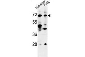 Western blot analysis of C21orf29 Antibody (Center) in MDA-MB231, K562 cell line lysates (35µg/lane). (TSPEAR 抗体  (Middle Region))