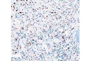 IHC analysis of CD68 using anti-CD68 antibody (ABIN7600142).