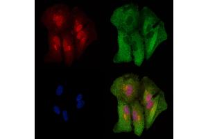 ABIN6262790 and ABIN6278915 staining  cells by IF/ICC. (KRT9 抗体  (Internal Region))