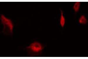 ABIN6267563 staining HeLa by IF/ICC. (RPS6 抗体  (pSer235))