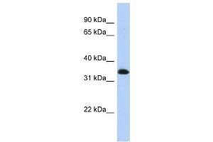 ZNF511 antibody used at 0. (ZNF511 抗体  (N-Term))