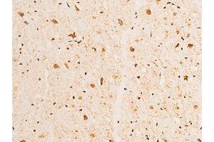 ABIN6267232 at 1/100 staining human heart tissue sections by IHC-P. (Tumor Protein p73 抗体  (pTyr99))