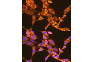 Immunofluorescence analysis of NIH-3T3 cells using F/UBD Rabbit mAb (ABIN7271134) at dilution of 1:100 (40x lens). (UBD 抗体)