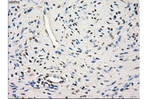 Immunohistochemical staining of paraffin-embedded endometrium tissue using anti-SLC2A6mouse monoclonal antibody.