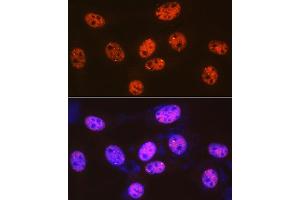 Immunofluorescence analysis of NIH-3T3 cells using 53BP1 Rabbit mAb (ABIN1679832, ABIN3018199, ABIN3018200 and ABIN7101582) at dilution of 1:100 (40x lens). (TP53BP1 抗体)