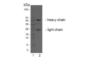 SDS-PAGE analysis of purified BBX-1H1 monoclonal antibody. (LGR4 抗体)
