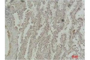 Immunohistochemistry (IHC) image for anti-cAMP Responsive Element Binding Protein 1 (CREB1) antibody (ABIN7178447)