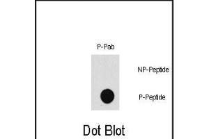 Dot blot analysis of Phospho-P3K7- polyclonal antibody (Cat. (MAP3K7 抗体  (pThr187))