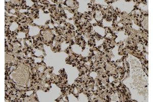ABIN6277116 at 1/100 staining Rat lung tissue by IHC-P. (XRCC3 抗体  (N-Term))