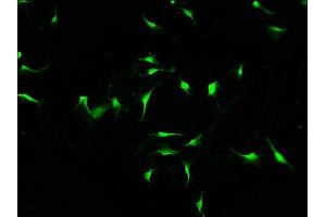 Immunofluorescence staining of U251 cells with ABIN7156399 at 1:100, counter-stained with DAPI. (INTS1 抗体  (AA 51-342))
